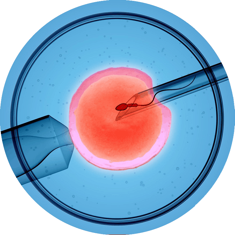 FERTILITY TREATMENT