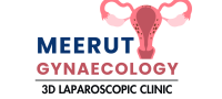 MEERUT GYNAECOLOGY